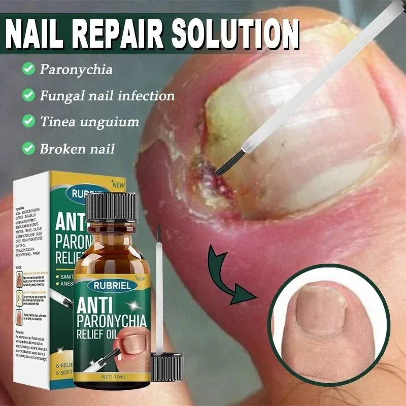 Anti Paronychia Relief Oil- Buy 1 Get 1 Free !