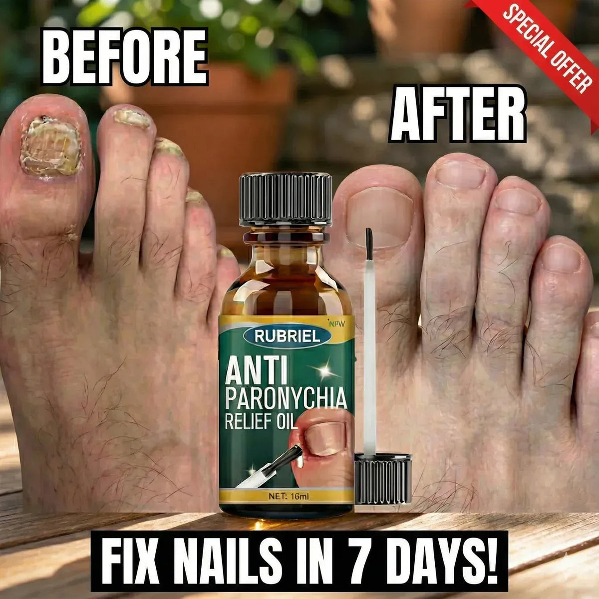 Anti Paronychia Relief Oil : Buy 1 Get 1 Free