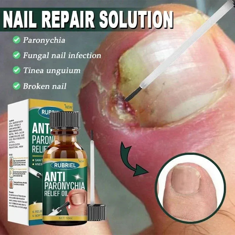 Anti Paronychia Relief Oil : Buy 1 Get 1 Free