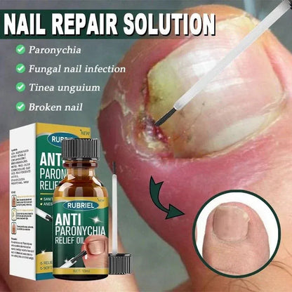 Anti Paronychia Relief Oil : Buy 1 Get 1 Free