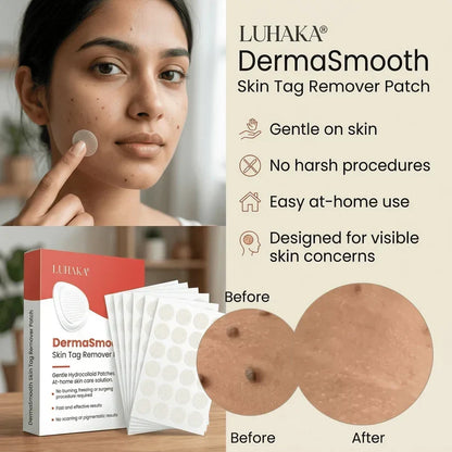 DermaSmooth Skin Tag Remover Patch