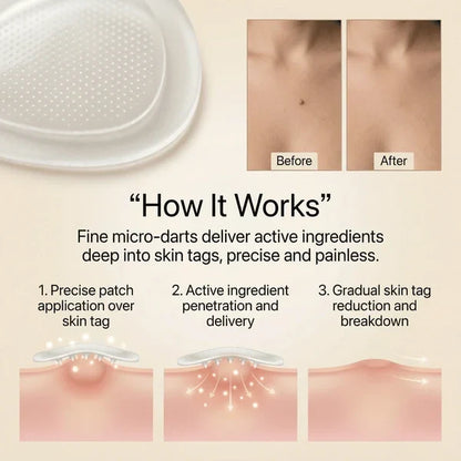 DermaSmooth Skin Tag Remover Patch